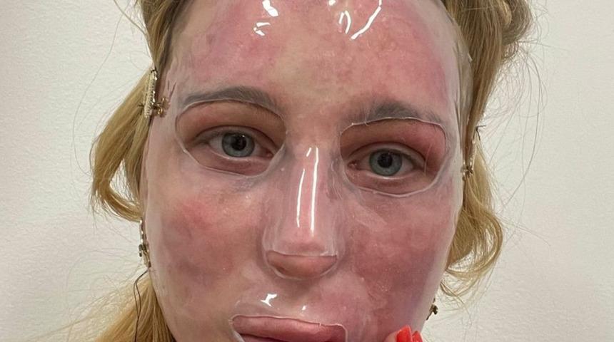 Olmaz olsun böyle arkadaş: Şaka kurbanı genç kadın tanınmaz hale geldi