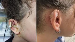 Takıcıda kulağını deldirdi, hayatı kabusa döndü! 'Uyuyamıyordum'