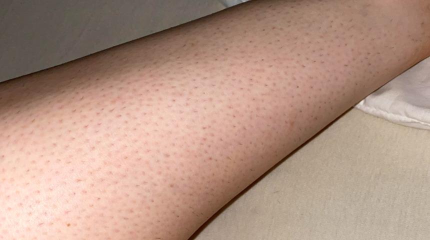 Ne batık kalır ne de kuruluk! Tüm problemleri pul pul dökecek