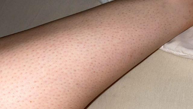 Ne batık kalır ne de kuruluk! Tüm problemleri pul pul dökecek