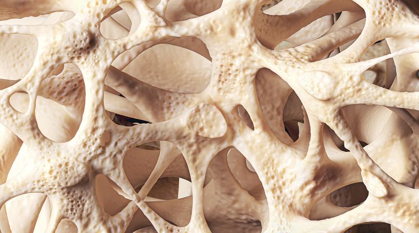 Kemikleri içten içe çürütüyor, kıl gibi inceltiyor, kırılmasına neden oluyor!