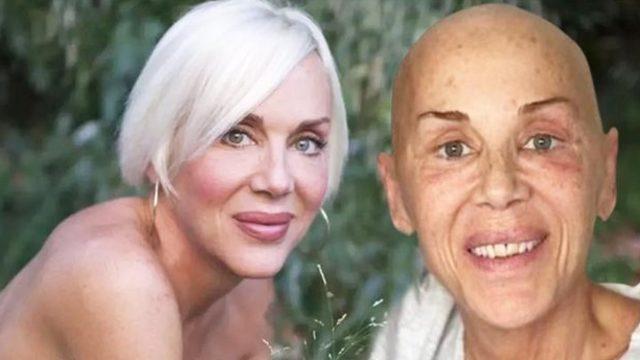 Billur Kalkavan'ın ölüm nedeni olan akciğer kanseri belirtileri nelerdir? Akciğer kanseri yaşam süresi ne ve tedavisi nasıl yapılır? Billur Kalkavan'dan acı haber!