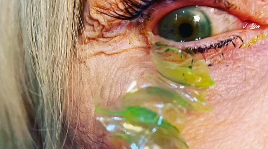 Hepsi gözünden çıktı: Tam 23 tane... "Hiç böyle bir şey görmedim"