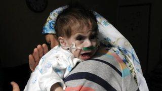 Kalp hastası minik Abdulkadir yardım bekliyor