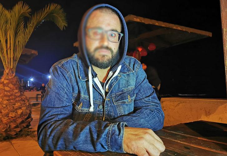 Samsun'da diş teknisyeni sol gözünü kaybetti! 'Bu olay benim hayatımı bitirdi' G2