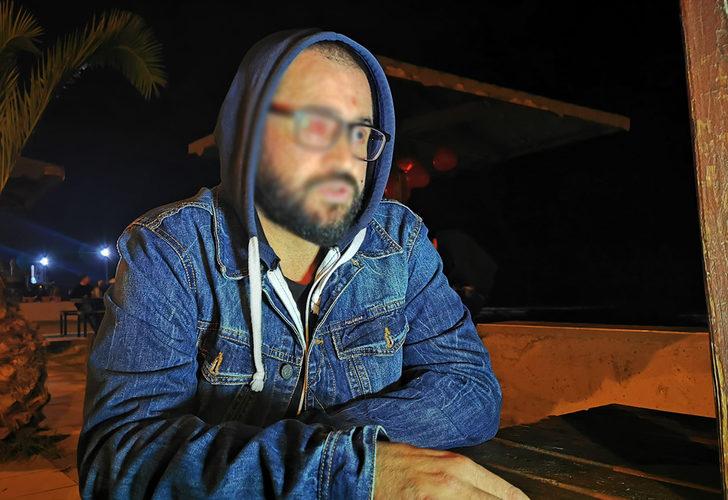 Samsun'da diş teknisyeni sol gözünü kaybetti! 'Bu olay benim hayatımı bitirdi' G4