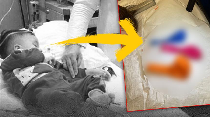 Midesinden çıkarılamayacak kadar büyüktü! 1 yaşındaki İsmet Cihat bebek herkesi korkuttu: Karın ağrısı başlayınca...