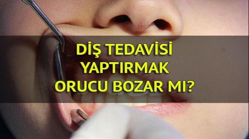 Diş tedavisi yaptırmak orucu bozar mı? İşte Diyanete göre orucu bozan durumlar...