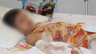 Küçük çocuk ne olduğunu anlayamadan acılar içinde kaldı! Baba: Hastaneye geldim, fenalaştım