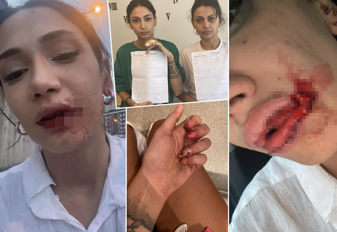 S&ouml;zl&uuml; tacize uğradılar, 'istemiyoruz' deyince tekme tokat d&ouml;v&uuml;ld&uuml;ler! 'G&ouml;z&uuml;m&uuml; a&ccedil;tığımda ne adam, ne araba vardı'