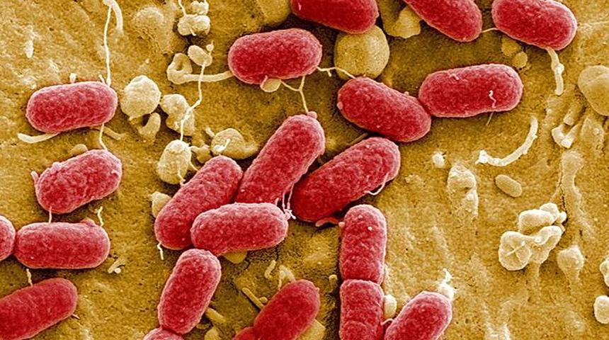 ABD'de et yiyen bakteri alarmı! Etkileri korkutucu: 65 vaka tespit edildi, 11 kişi hayatını kaybetti! Vücuda böyle giriyor...