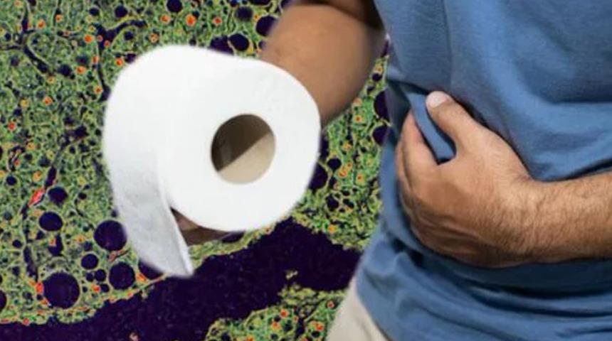 İlk zamanlarda zararsızdır; tedavi edilmezse... Melena’yı fark ettiğiniz an harekete geçin 