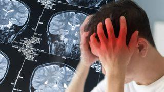 Aylar önce uyarı veriyor! Felcin ölümcül etkisinden korunmak için bu belirtiye dikkat edin