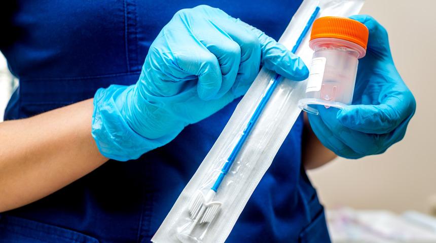 Smear testi sonucu öğrenme: Smear testi sonucunu nasıl öğrenebilirim, simir testi sorgulama nasıl yapılır?