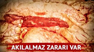 Sağlığınızı perişan etmek istiyorsanız yemeye devam edin! Akılalmaz zararları var