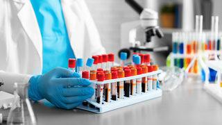 Kan tahlilleri ne zaman, kaç saat çıkar? Kan ve idrar tahlili sonucu ne kadar sürede çıkar, ne zaman e-Nabız'a düşer?