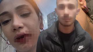 Gece kulübünden çıkıp yolda yürürken dehşeti yaşamışlardı! Şüpheli, genç kızı takıntı haline getirmiş