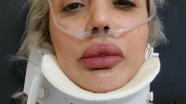 Hayvansever kadını tekme tokat dövdüler! 'Omurilik zedelenmesi var, kadını üzerimden zor aldılar'