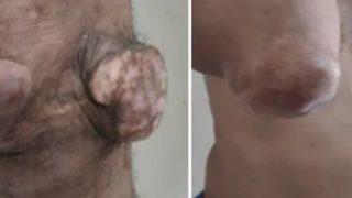 Genç yaşında bu hale geldi! Sebebi sonra anlaşıldı