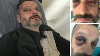 Bir istek parça dehşeti daha... İstedikleri çiftetelliyi hemen çalmadı diye müzisyeni öldüresiye dövdüler! O anlar kamerada