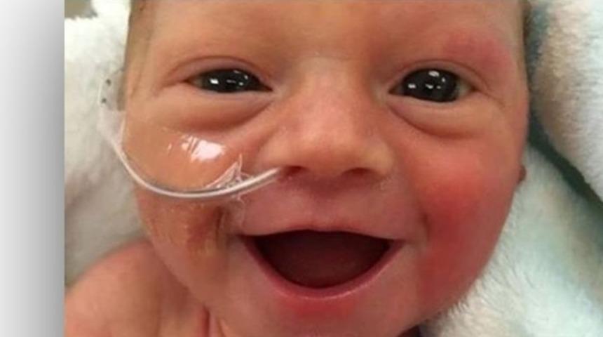 Premat&uuml;re bebek sosyal medyada fenomen oldu