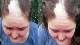 Saçları kökünden koparılan Bergül Varan için suç duyurusu