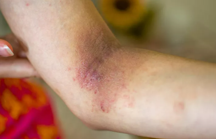 Herkesin evinde olması şart: Özellikle 40 yaş üstü kadınlar direkt alın! Menopoz semptomlarını hafifletir G1