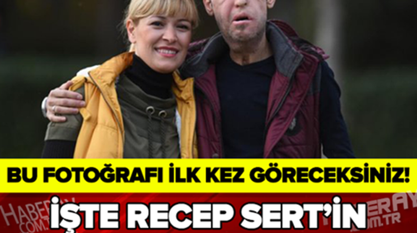 Recep Sert'in Kazadan Önceki Halini Görünce ŞOK Olucaksınız