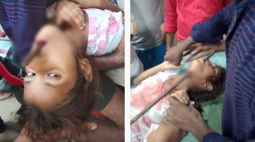 ''Gördüğüm en acı vaka!'': Metal bir çubuğun üzerine düştü! Alt çenesinden girip ağzından çıktı