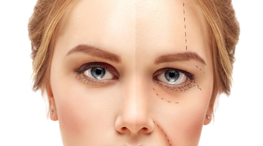 Kaş ve göz kapağı düşüklüğü nasıl tedavi edilir?