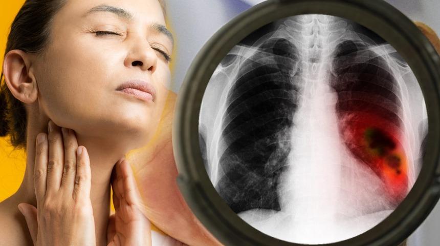 Boğaz ağrısını hafife almayın! En ciddi sağlık sorunlarından biri