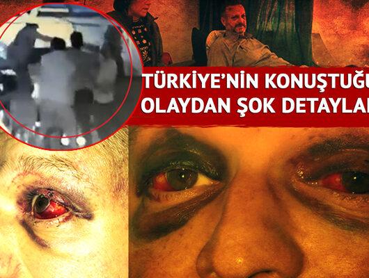 Gece kulübündeki vahşeti anlattı: Karanlıktaydım, beni buldular