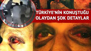 Arka bahçede karanlıkta bulup dövmüşler! Türkiye'nin konuştuğu 'çiftetelli' dehşetinden şok detaylar: Korkarak yaşamaya alışacağız