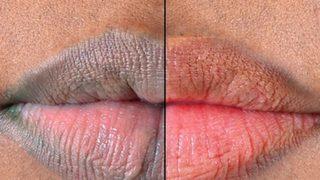 Her evde bulunuyor! Doğal pembe dudaklar için kullanabileceğiniz malzemeler