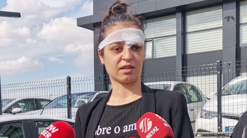 Eski eş dehşeti! Öldüresiye dövüp yerlerde sürükledi