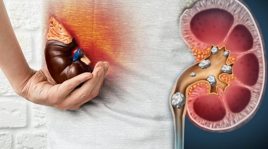 Adım adım ölüme götürüyor: Böbreklerinizin en büyük düşmanı!