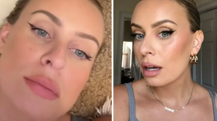 Bu trend riskli! Hailey Bieber'ın sa&ccedil; stilini denediği i&ccedil;in sa&ccedil;ı tutam tutam d&ouml;k&uuml;ld&uuml;