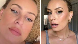 Bu trend riskli! Hailey Bieber'ın saç stilini denediği için saçı tutam tutam döküldü