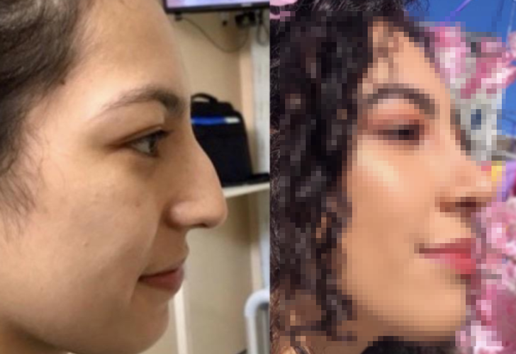 Kadınlar ufacık detayların görünümü ne kadar değiştirebileceğini gösteriyor