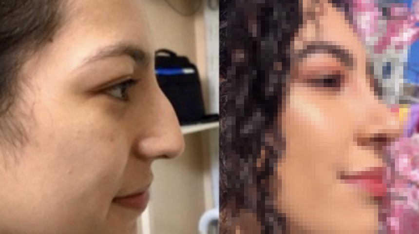 Kadınlar ufacık detayların g&ouml;r&uuml;n&uuml;m&uuml; ne kadar değiştirebileceğini g&ouml;steriyor