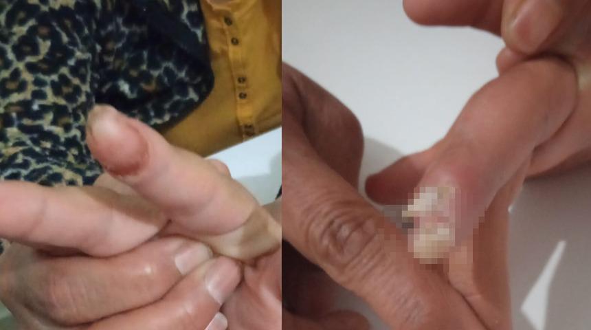 Engelli bakım merkezinde skandal olay! Yeğeninin vücudundakileri görünce gözlerine inanamadı