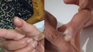 Engelli bakım merkezinde skandal olay! Yeğeninin vücudundakileri görünce gözlerine inanamadı