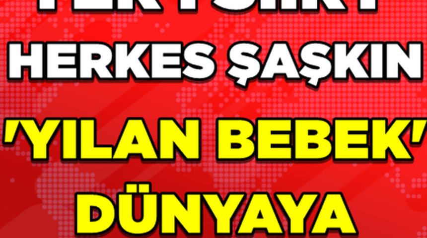 Siirt'te Yılan Bebek D&uuml;nyaya Geldi!