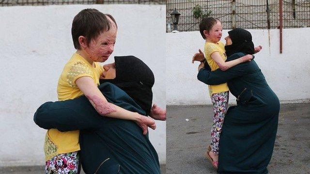 Evlerine düşen bombadan sonra ilk kez...