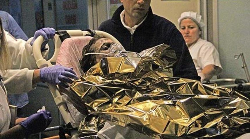 Tartıştığı Eşinin &Uuml;zerine Benzin D&ouml;k&uuml;p Ateşe Verdi