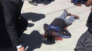 Son dakika: AK Partili belediye başkanına silahlı saldırı