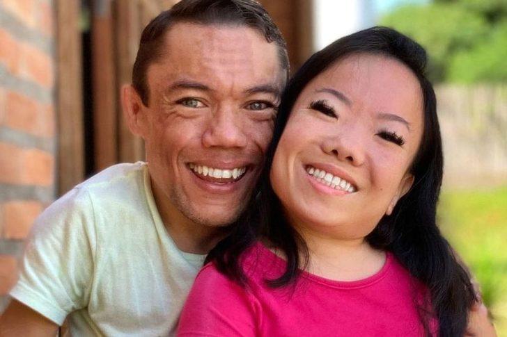 Dünyanın en kısa boylu çifti olarak Guinness Dünya Rekorlar Kitabı’na girmişlerdi! “Günlük hayat bizim için zor” G4