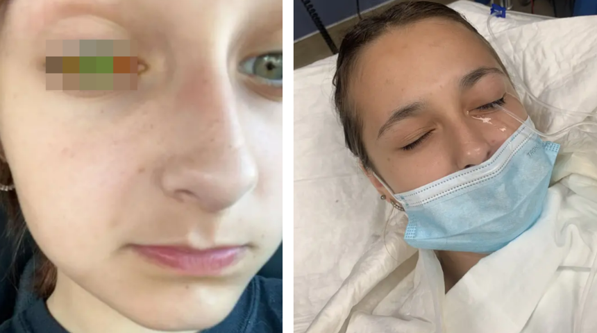 Kullanmadan önce tekrar düşünün! Saç boyası kör kalmasına neden oldu