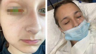 Kullanmadan önce tekrar düşünün! Saç boyası kör kalmasına neden oldu