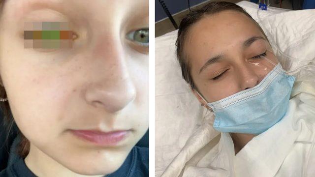 Kullanmadan önce tekrar düşünün! Saç boyası kör kalmasına neden oldu